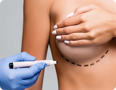 Breast Augmentation