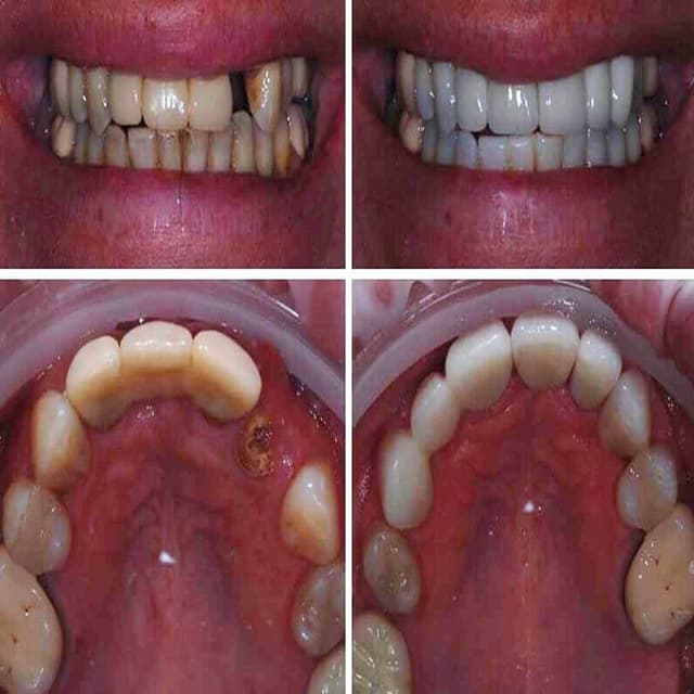 alaanmed