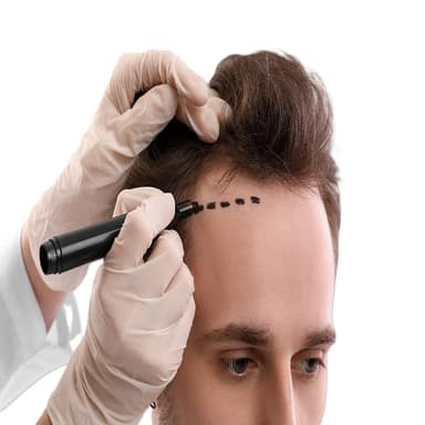 Hair Transplant
