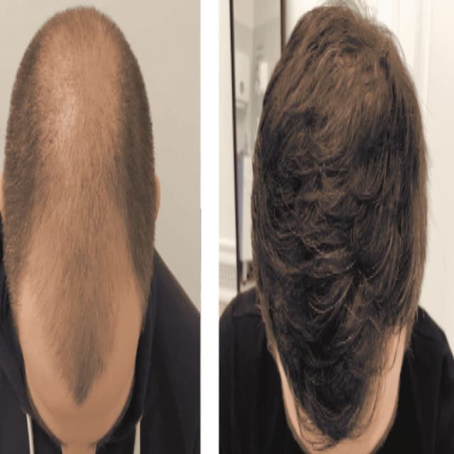 alaanmed