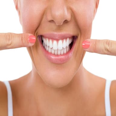 Teeth bleaching