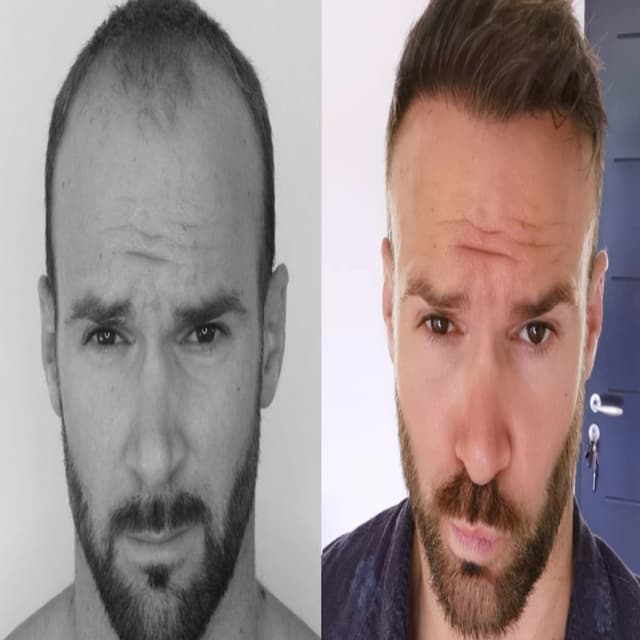 alaanmed