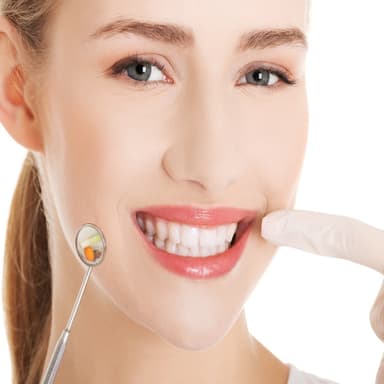 Veneers & Composite Fillings