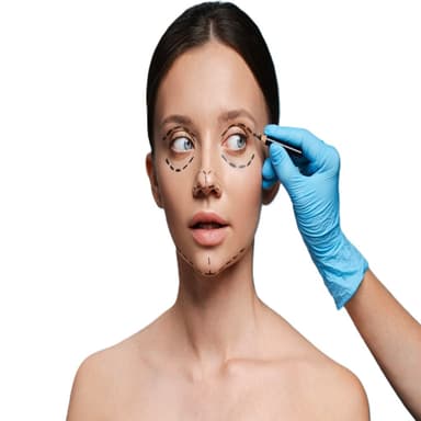 Blepharoplasty