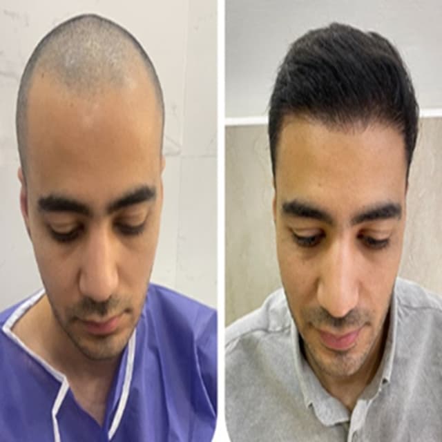 alaanmed