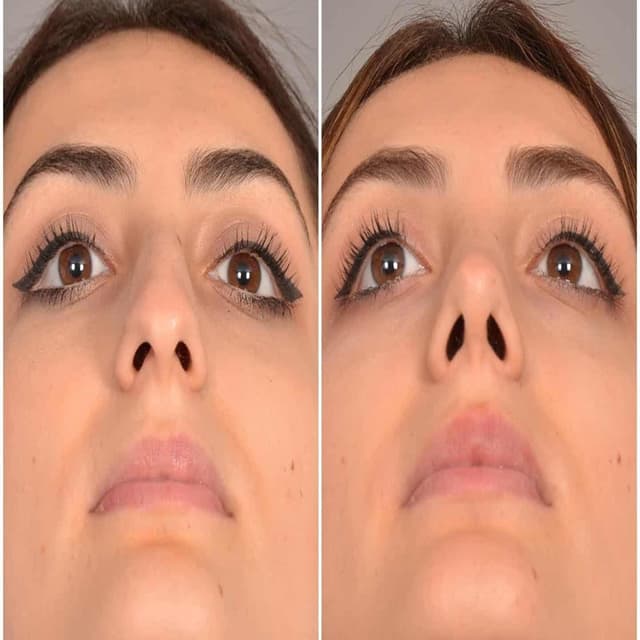 alaanmed