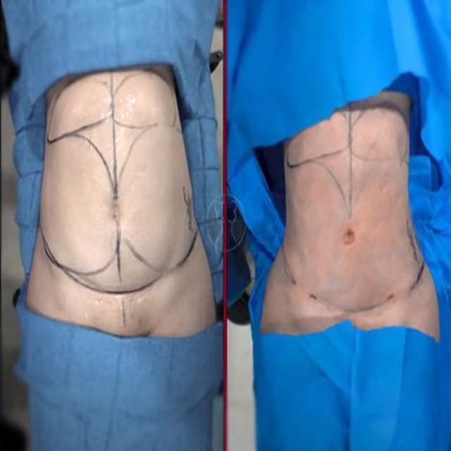 alaanmed