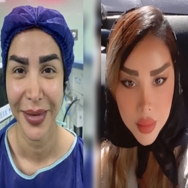 alaanmed