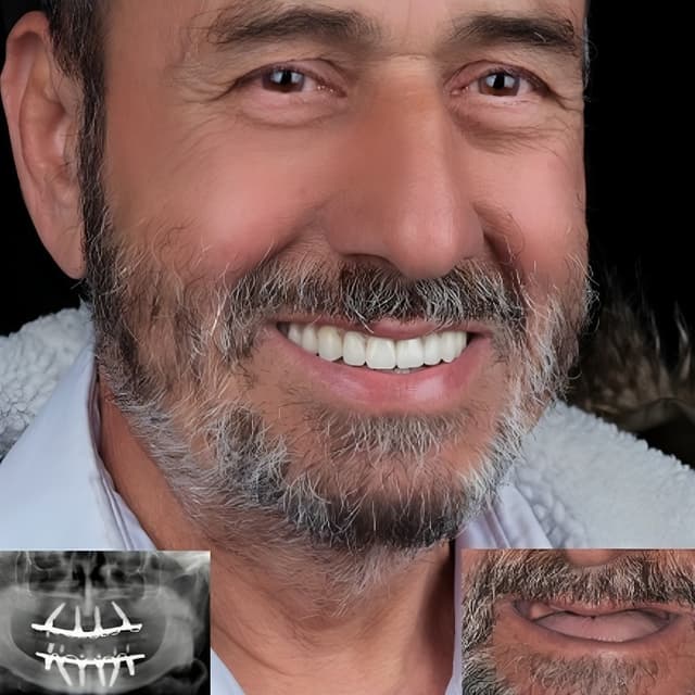 alaanmed