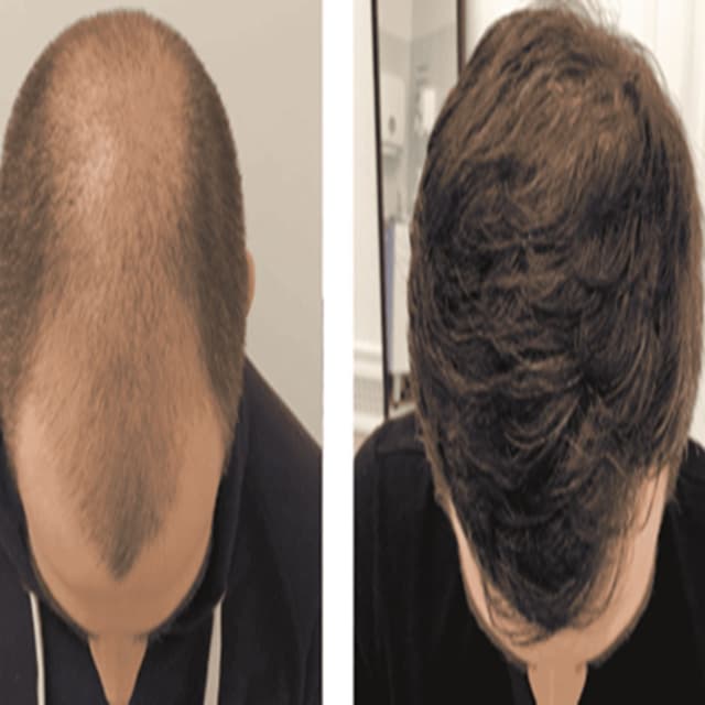 alaanmed