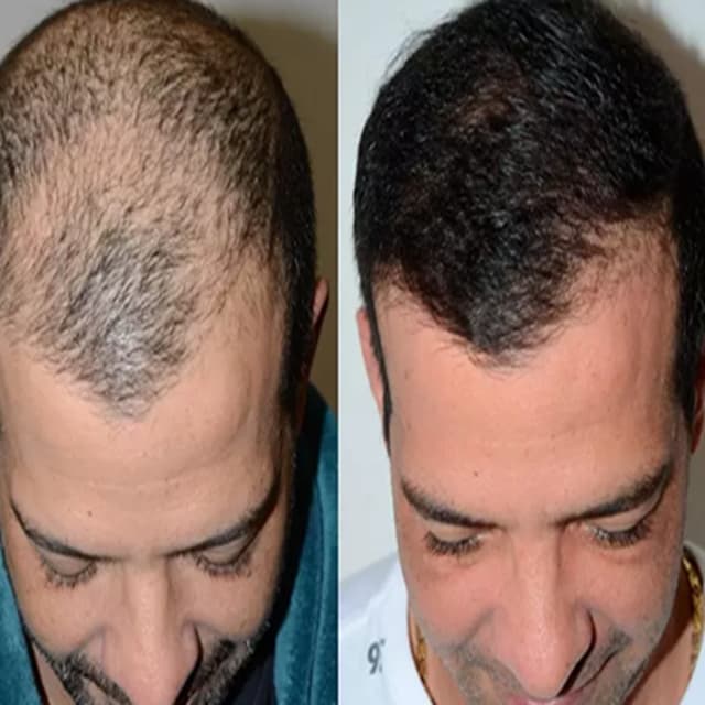 alaanmed