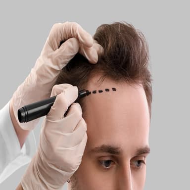 Hair Transplant