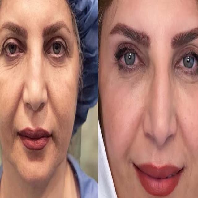 alaanmed